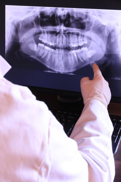 Best Emergency Dental Care for Sports Injuries in Martinez, GA