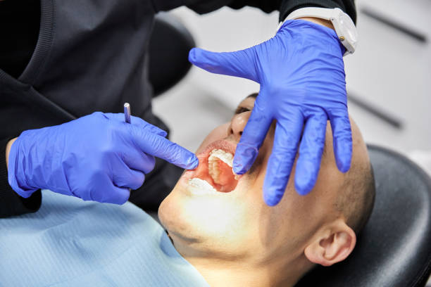 Best Broken or Chipped Tooth Repair in Martinez, GA