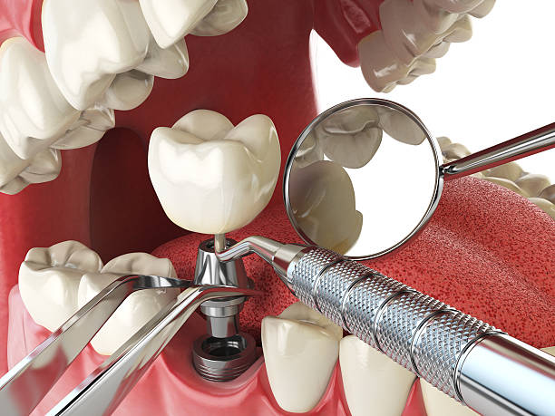 Best Emergency Denture Repair in Martinez, GA